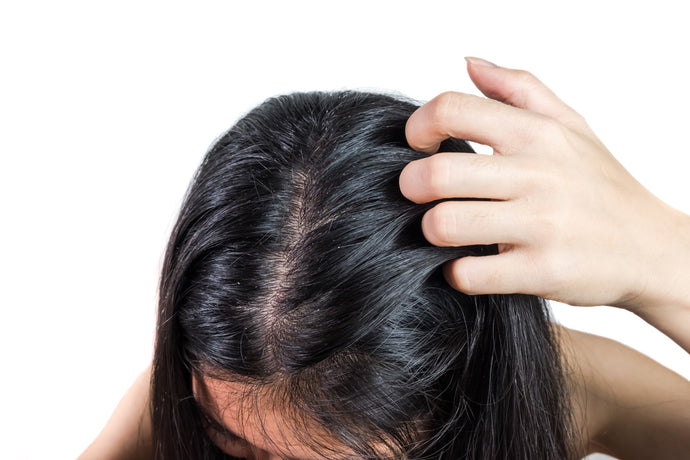 9 Natural Dandruff Remedies That Work